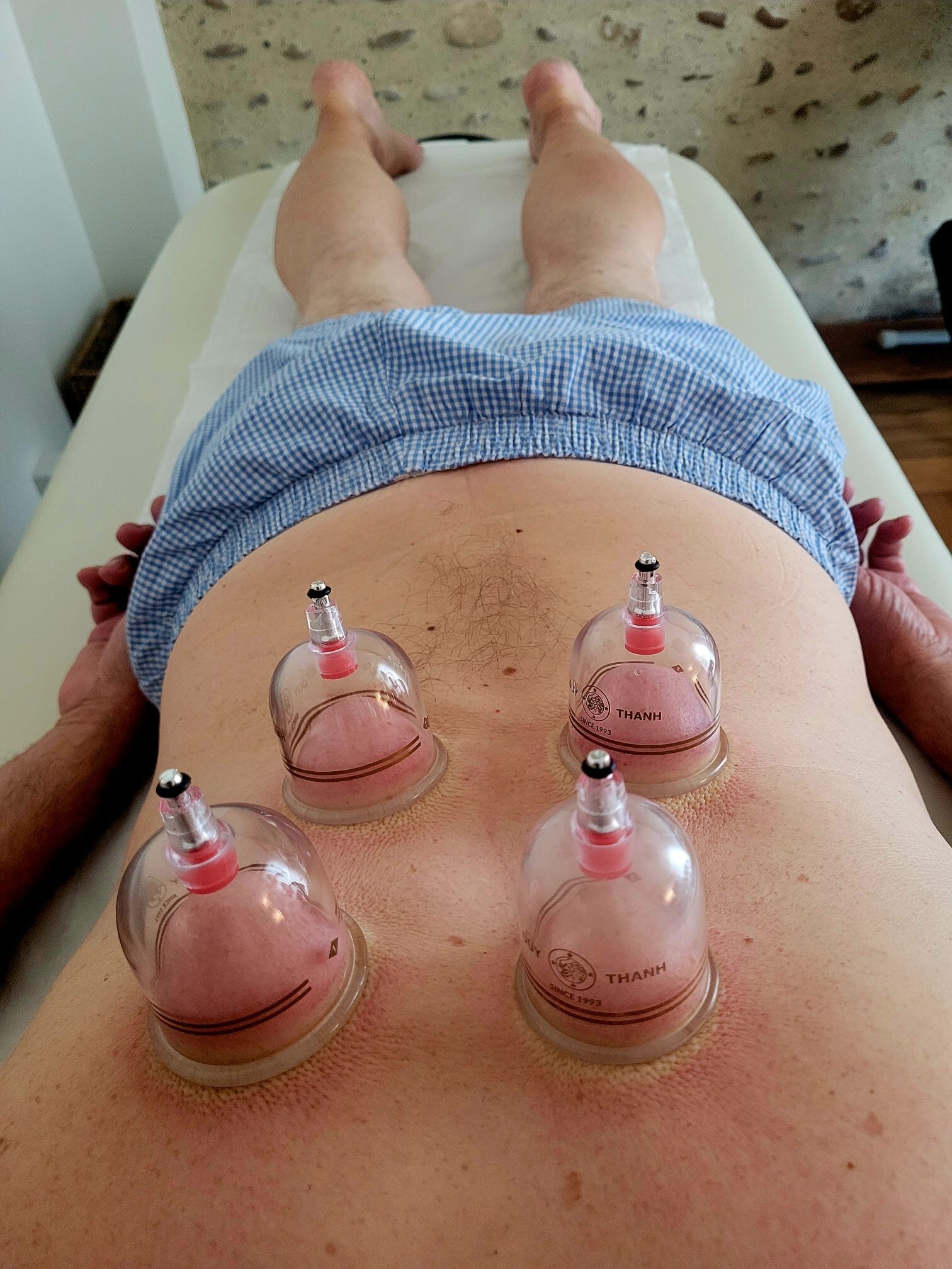 Utilisation des ventouses