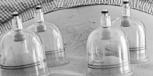 Utilisation des ventouses en reflexologie combinée